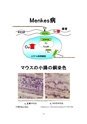 厚生労働科学研究費補助金（難治性疾患克服研究事業）「Menkes病・occipital horn症候群の実態調査、早期診断基準確立、治療法開発に関する研究」平成22年度 総括・分担研究報告書