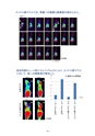 厚生労働科学研究費補助金（難治性疾患克服研究事業） 「Menkes 病・occipital horn 症候群の実態調査、早期診断基準確立、治療法開発に関する研究」 平成23年度 総括・分担研究報告書