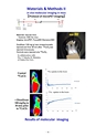 厚生労働科学研究費補助金（難治性疾患克服研究事業） 「Menkes 病・occipital horn 症候群の実態調査、早期診断基準確立、治療法開発に関する研究」 平成23年度 総括・分担研究報告書